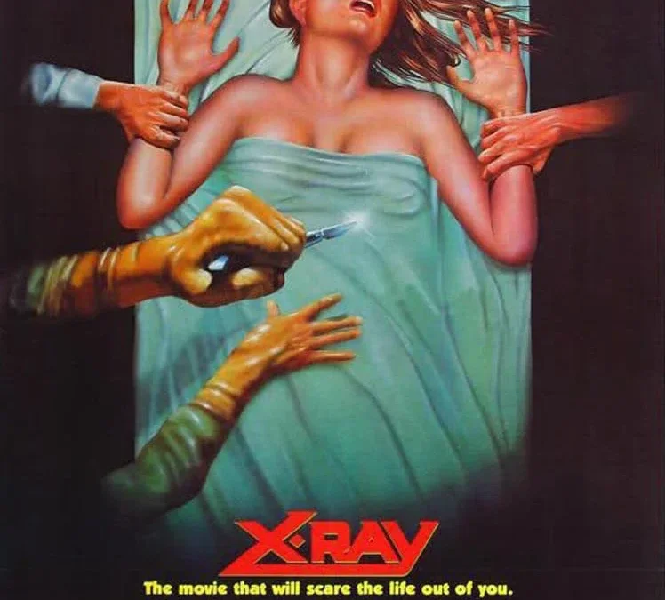 x ray